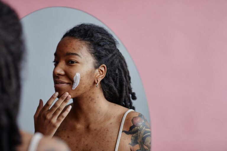 Woman applying skincare cream to areas of uneven skin tone as part of a pigmentation products routine